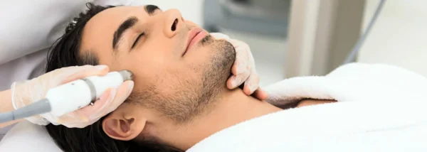 dermapen-microneedling-homme-Limoges